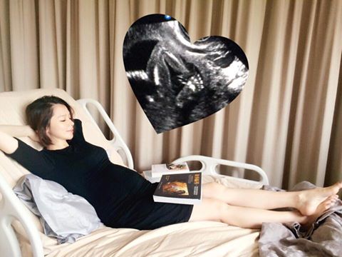 創造徐若瑄高顏值的睡不醒頭
